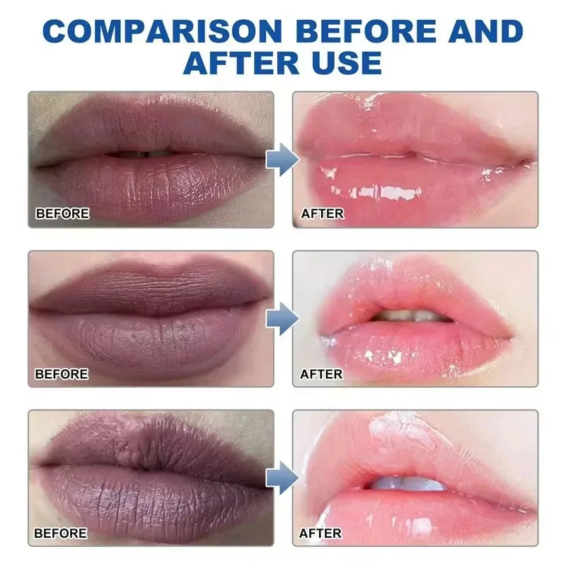 Remove Dark Lip Balm Fast Lightening Pink Lip Exfoliating Fade Lip