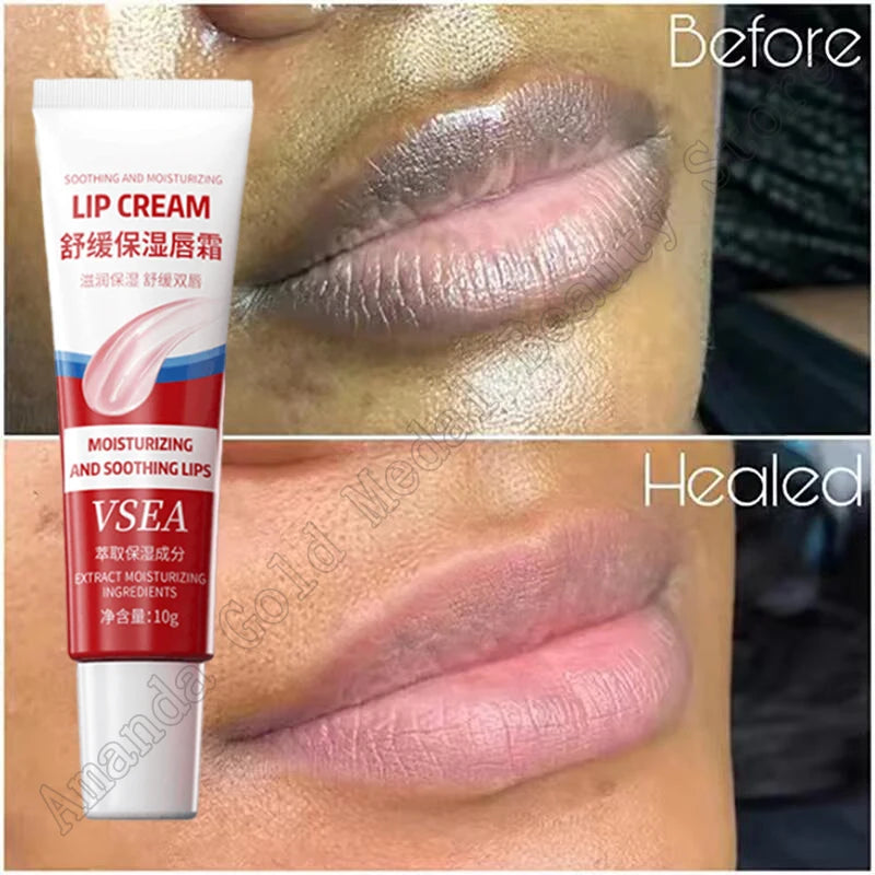 Remove Dark Lip Balm Fast Lightening Pink Lip Exfoliating Fade Lip
